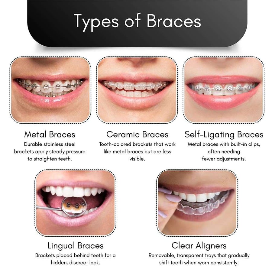 Dental Braces in Brooklyn
