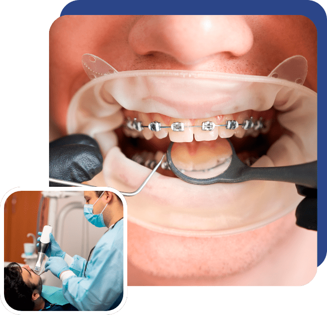 Orthodontic Treatments in East Bronx, NY