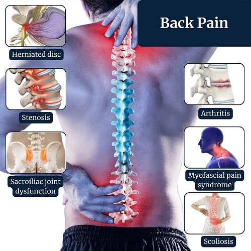 Back Pain Treatment in Irving, TX & Dallas, TX