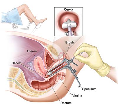 Pap Smear – OB/GYN Physicians