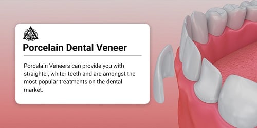 Porcelain Dental Veneers in Astoria, Queens, NY
