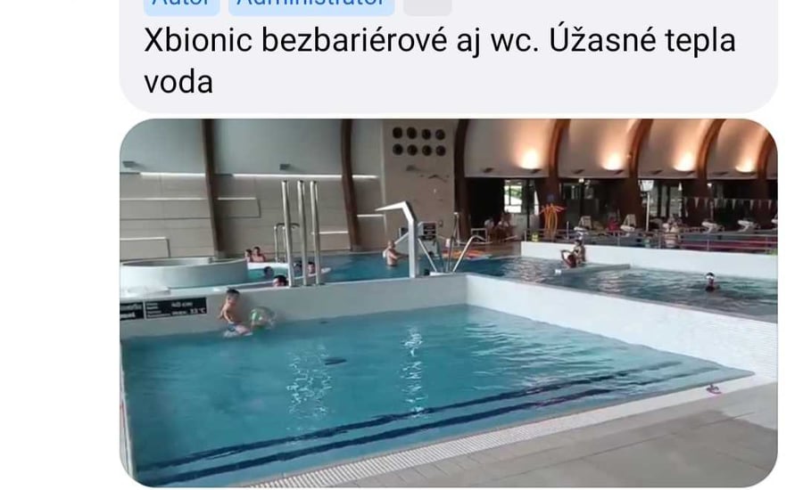 Xbionoc